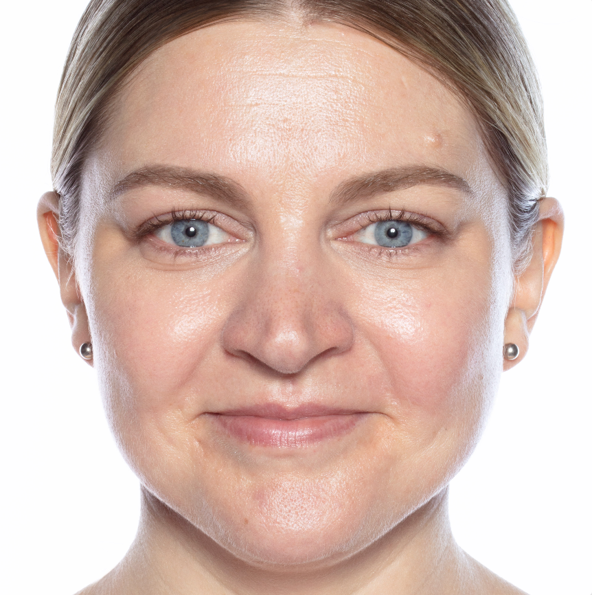 After Using Good Genes After using Good Genes