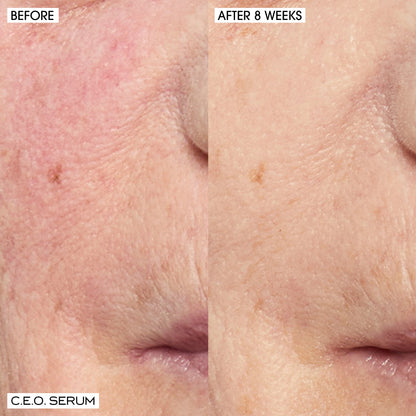 Home + Away Brighten, Revitalize + Glow