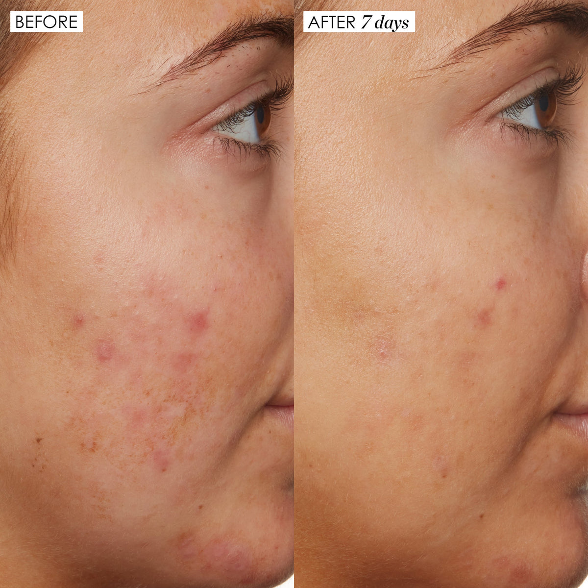 B3 Nice 10% Niacinamide Serum – Sunday Riley