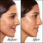 Before and After results image showing the improved skin after using A+ High-Dose Retinoid Serum side-by-side