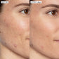 Good Genes before and after, face and cheek close up. Visually reduced the look of dark spots, dark spots, and discoloration caused by exposure to the sun 7 days of use
