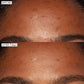 Good Genes before and after, forehead close up. Visually reduced the look of dark spots, dark spots, and discoloration caused by exposure to the sun 7 days of use